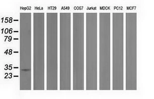 WB analysis of various cell lines using GTX83911 PECR antibody [1E4]. Loading : 35 ug per lane