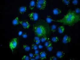 ICC/IF analysis of COS7 cells transiently transfected with PECR plasmid using GTX83911 PECR antibody [1E4].
