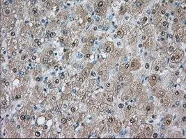 IHC-P analysis of liver tissue using GTX83921 PDE4A antibody [6B6]. Antigen retrieval : Heat-induced epitope retrieval by 10mM citrate buffer, pH6.0, 100oC for 10min. Dilution : 1:50