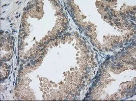 IHC-P analysis of prostate tissue using GTX83921 PDE4A antibody [6B6]. Antigen retrieval : Heat-induced epitope retrieval by 10mM citrate buffer, pH6.0, 100oC for 10min. Dilution : 1:50
