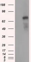 WB analysis of HEK293T cells transfected with PDE4A plasmid (Right) or empty vector (Left) for 48 hrs using GTX83921 PDE4A antibody [6B6]. Loading : 5 ug per lane