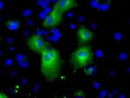 ICC/IF analysis of COS7 cells transiently transfected with PDE4A plasmid using GTX83921 PDE4A antibody [6B6].
