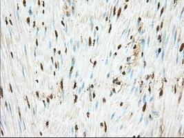 IHC-P analysis of human colon tissue using GTX83922 PDE4A antibody [7B11]. Antigen retrieval : Heat-induced epitope retrieval by 10mM citrate buffer, pH6.0, 100oC for 10min. Dilution : 1:50