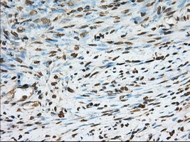 IHC-P analysis of human endometrium tissue using GTX83922 PDE4A antibody [7B11]. Antigen retrieval : Heat-induced epitope retrieval by 10mM citrate buffer, pH6.0, 100oC for 10min. Dilution : 1:50