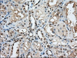 IHC-P analysis of human kidney tissue using GTX83922 PDE4A antibody [7B11]. Antigen retrieval : Heat-induced epitope retrieval by 10mM citrate buffer, pH6.0, 100oC for 10min. Dilution : 1:50