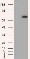WB analysis of HEK293T cells transfected with PDE4A plasmid (Right) or empty vector (Left) for 48 hrs using GTX83922 PDE4A antibody [7B11]. Loading : 5 ug per lane