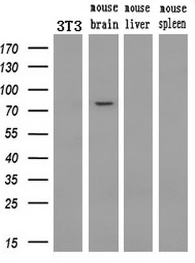 WB analysis of various samples using GTX83931 PDE10A antibody [1B2]. Loading : 10 ug per lane Dilution : 1:200