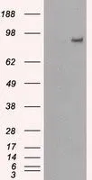 WB analysis of HEK293T cells transfected with PDE10A plasmid (Right) or empty vector (Left) for 48 hrs using GTX83931 PDE10A antibody [1B2]. Loading : 5 ug per lane