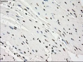 IHC-P analysis of bladder tissue using GTX83933 PDE10A antibody [1C9]. Antigen retrieval : Heat-induced epitope retrieval by 10mM citrate buffer, pH6.0, 100oC for 10min. Dilution : 1:50