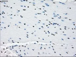 IHC-P analysis of colon tissue using GTX83933 PDE10A antibody [1C9]. Antigen retrieval : Heat-induced epitope retrieval by 10mM citrate buffer, pH6.0, 100oC for 10min. Dilution : 1:50