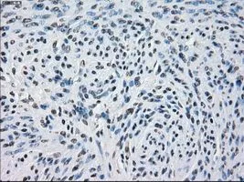 IHC-P analysis of endometrium tissue using GTX83933 PDE10A antibody [1C9]. Antigen retrieval : Heat-induced epitope retrieval by 10mM citrate buffer, pH6.0, 100oC for 10min. Dilution : 1:50