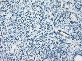 IHC-P analysis of ovary tissue using GTX83933 PDE10A antibody [1C9]. Antigen retrieval : Heat-induced epitope retrieval by 10mM citrate buffer, pH6.0, 100oC for 10min. Dilution : 1:50