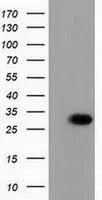 WB analysis of HEK293T cells transfected with PBLD plasmid (Right) or empty vector (Left) for 48 hrs using GTX83938 PBLD antibody [7G5]. Loading : 5 ug per lane