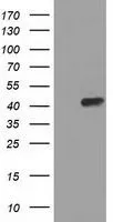 WB analysis of HEK293T cells transfected with PAICS plasmid (Right) or empty vector (Left) for 48 hrs using GTX83948 PAICS antibody [1B4]. Loading : 5 ug per lane
