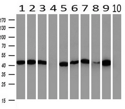 WB analysis of human tissues (Lane 1-Testis ; Lane 2-Omentum ; Lane 3-Uterus ; Lane 4-Breast ; Lane 5-Brain ; Lane 6-Liver ; Lane 7-Ovary ; Lane 8-Thyroid gland ; Lane 9-colon ; Lane 10-spleen) using GTX83949 PAICS antibody [5B6]. Loading : 10 ug per lane Dilution : 1:500
