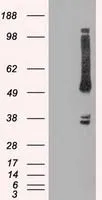 WB analysis of HEK293T cells transfected with OXSR1 plasmid (Right) or empty vector (Left) for 48 hrs using GTX83951 OXSR1 antibody [1F3]. Loading : 5 ug per lane