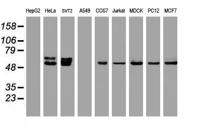WB analysis of various cell lines using GTX83951 OXSR1 antibody [1F3]. Loading : 35 ug per lane