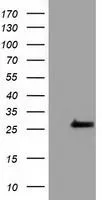 WB analysis of HEK293T cells transfected with OTUB2 plasmid (Right) or empty vector (Left) for 48 hrs using GTX83952 OTUB2 antibody [6C7]. Loading : 5 ug per lane