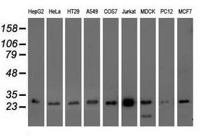 WB analysis of HEK293T cells transfected with OTUB2 plasmid (Right) or empty vector (Left) for 48 hrs using GTX83953 OTUB2 antibody [11B3]. Loading : 5 ug per lane