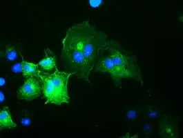 ICC/IF analysis of COS7 cells transiently transfected with OSBPL11 plasmid using GTX83960 OSBPL11 antibody [6A6].