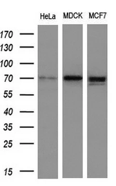 WB analysis of various cell lines using GTX83974 NUMB antibody [1A7]. Loading : 10 ug per lane Dilution : 1:200
