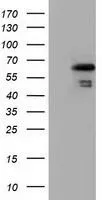 WB analysis of HEK293T cells transfected with NUMB plasmid (Right) or empty vector (Left) for 48 hrs using GTX83974 NUMB antibody [1A7]. Loading : 5 ug per lane
