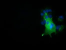 ICC/IF analysis of COS7 cells transiently transfected with NUMB plasmid using GTX83974 NUMB antibody [1A7].