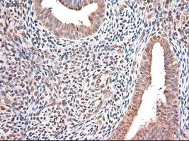 IHC-P analysis of endometrium tissue using GTX83983 Neurotrophin 3 antibody [5C7]. Antigen retrieval : Heat-induced epitope retrieval by 10mM citrate buffer, pH6.0, 100oC for 10min.