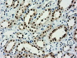 IHC-P analysis of human kidney tissue using GTX83992 NT5DC1 antibody [1E11]. Antigen retrieval : Heat-induced epitope retrieval by 10mM citrate buffer, pH6.0, 100oC for 10min.