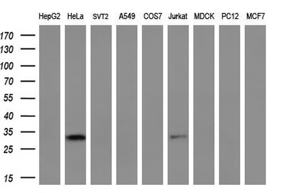 WB analysis of various cell lines using GTX83996 NSE2 antibody [4H9]. Loading : 35 ug per lane Dilution : 1:200