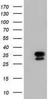WB analysis of HEK293T cells transfected with NSE2 plasmid (Right) or empty vector (Left) for 48 hrs using GTX83996 NSE2 antibody [4H9]. Loading : 5 ug per lane