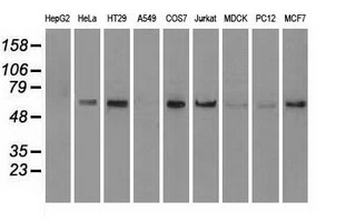 WB analysis of various cell lines using GTX84000 NRBP1 antibody [7E2]. Loading : 35 ug per lane