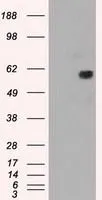 WB analysis of HEK293T cells transfected with NRBP1 plasmid (Right) or empty vector (Left) for 48 hrs using GTX84000 NRBP1 antibody [7E2]. Loading : 5 ug per lane