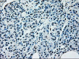 IHC-P analysis of human pancreas tissue using GTX84003 NRBP1 antibody [6C11]. Antigen retrieval : Heat-induced epitope retrieval by 10mM citrate buffer, pH6.0, 100oC for 10min.