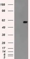 WB analysis of HEK293T cells transfected with NRBP1 plasmid (Right) or empty vector (Left) for 48 hrs using GTX84003 NRBP1 antibody [6C11]. Loading : 5 ug per lane