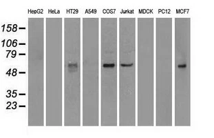 WB analysis of various cell lines using GTX84003 NRBP1 antibody [6C11]. Loading : 35 ug per lane