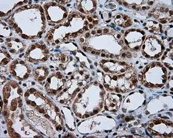 IHC-P analysis of kidney tissue using GTX84010 NPR-C antibody [4C3]. Antigen retrieval : Heat-induced epitope retrieval by 10mM citrate buffer, pH6.0, 100oC for 10min. Dilution : 1:50
