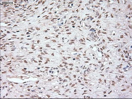 IHC-P analysis of human ovary tissue using GTX84022 Noggin antibody [1H8]. Antigen retrieval : Heat-induced epitope retrieval by 10mM citrate buffer, pH6.0, 100oC for 10min.