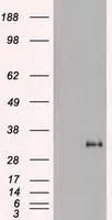 WB analysis of HEK293T cells transfected with Noggin plasmid (Right) or empty vector (Left) for 48 hrs using GTX84022 Noggin antibody [1H8]. Loading : 5 ug per lane