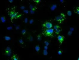 ICC/IF analysis of COS7 cells transiently transfected with Noggin plasmid using GTX84022 Noggin antibody [1H8].