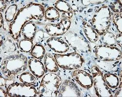 IHC-P analysis of kidney tissue using GTX84028 NME4 antibody [5E4]. Antigen retrieval : Heat-induced epitope retrieval by 10mM citrate buffer, pH6.0, 100oC for 10min. Dilution : 1:50