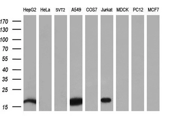 WB analysis of various cell lines using GTX84028 NME4 antibody [5E4]. Loading : 35 ug per lane Dilution : 1:200