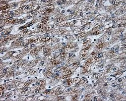 IHC-P analysis of liver tissue using GTX84032 NME4 antibody [1A5]. Antigen retrieval : Heat-induced epitope retrieval by 10mM citrate buffer, pH6.0, 100oC for 10min. Dilution : 1:50