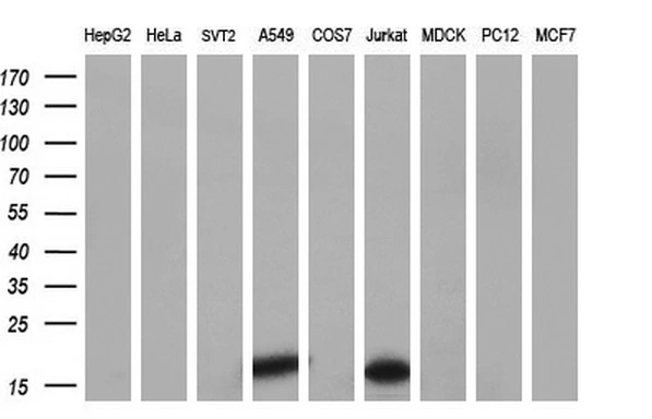 WB analysis of various cell lines using GTX84032 NME4 antibody [1A5]. Loading : 35 ug per lane Dilution : 1:200