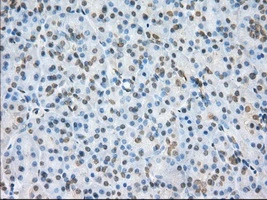 IHC-P analysis of human pancreas tissue using GTX84034 NME4 antibody [4F10]. Antigen retrieval : Heat-induced epitope retrieval by 10mM citrate buffer, pH6.0, 100oC for 10min. Dilution : 1:50