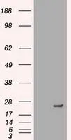 WB analysis of HEK293T cells transfected with Neurogenin 1 plasmid (Right) or empty vector (Left) for 48 hrs using GTX84049 Neurogenin 1 antibody [10B10]. Loading : 5 ug per lane