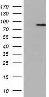 WB analysis of HEK293T cells transfected with NEK11 plasmid (Right) or empty vector (Left) for 48 hrs using GTX84061 NEK11 antibody [5E9]. Loading : 5 ug per lane
