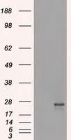 WB analysis of HEK293T cells transfected with NAT8 plasmid (Right) or empty vector (Left) for 48 hrs using GTX84062 NAT8 antibody [6H3]. Loading : 5 ug per lane