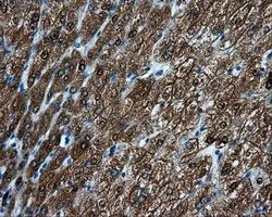IHC-P analysis of liver tissue using GTX84071 MTRF1L antibody [1B3]. Antigen retrieval : Heat-induced epitope retrieval by 10mM citrate buffer, pH6.0, 100oC for 10min. Dilution : 1:50