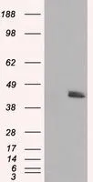 WB analysis of HEK293T cells transfected with MTRF1L plasmid (Right) or empty vector (Left) for 48 hrs using GTX84071 MTRF1L antibody [1B3]. Loading : 5 ug per lane
